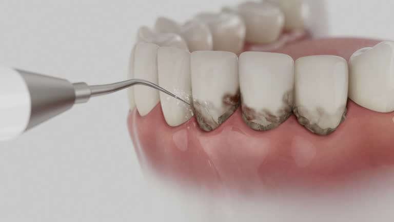 Trusted Dental Implants service in Stamps, AR - Dentist Open Now